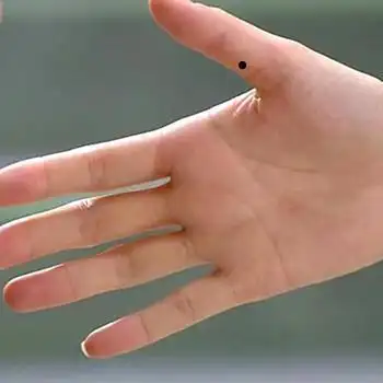 不同位置的痣代表含义各不相同手指间有痣的人命运好吗