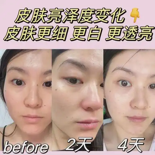 这变化,太惊人了吧|淡斑|抗皱|面膜|美白针_网易订阅