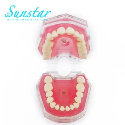 医疗器械  牙科设备  其他牙科设备  成人透明的可拆卸牙齿模型 热眄