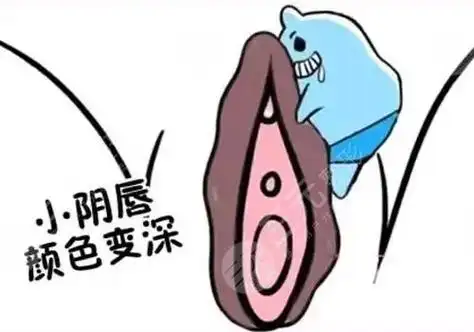 一,私密粉嫩有哪些方式?