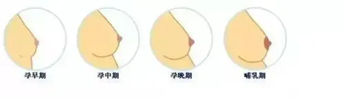 妇科·产科·不孕不育 有好多母乳的妈妈抱怨,生完宝宝后乳房就变得不