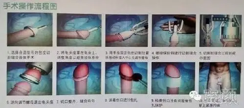 术后伤口愈合,缝订自然脱落.约一周可以洗澡,但不能泡澡或游泳.