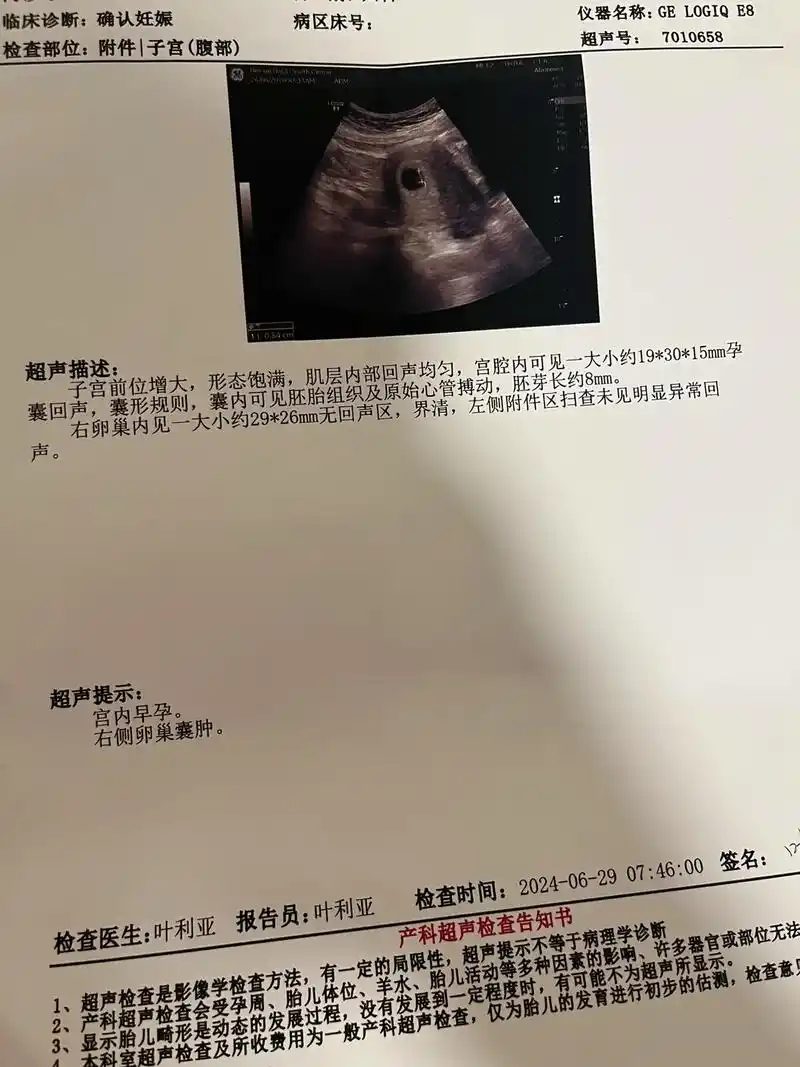 热乎乎的胎心胎芽来了,都说孕早期六到七周的初次b超单孕囊形状 - 抖