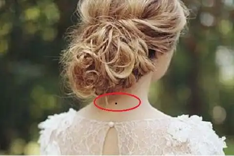 靠山痣和苦情痣有什么区别在什么位置