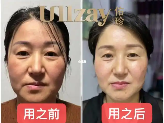 50岁有好皮肤在家就可以隔天一次紧致提升q