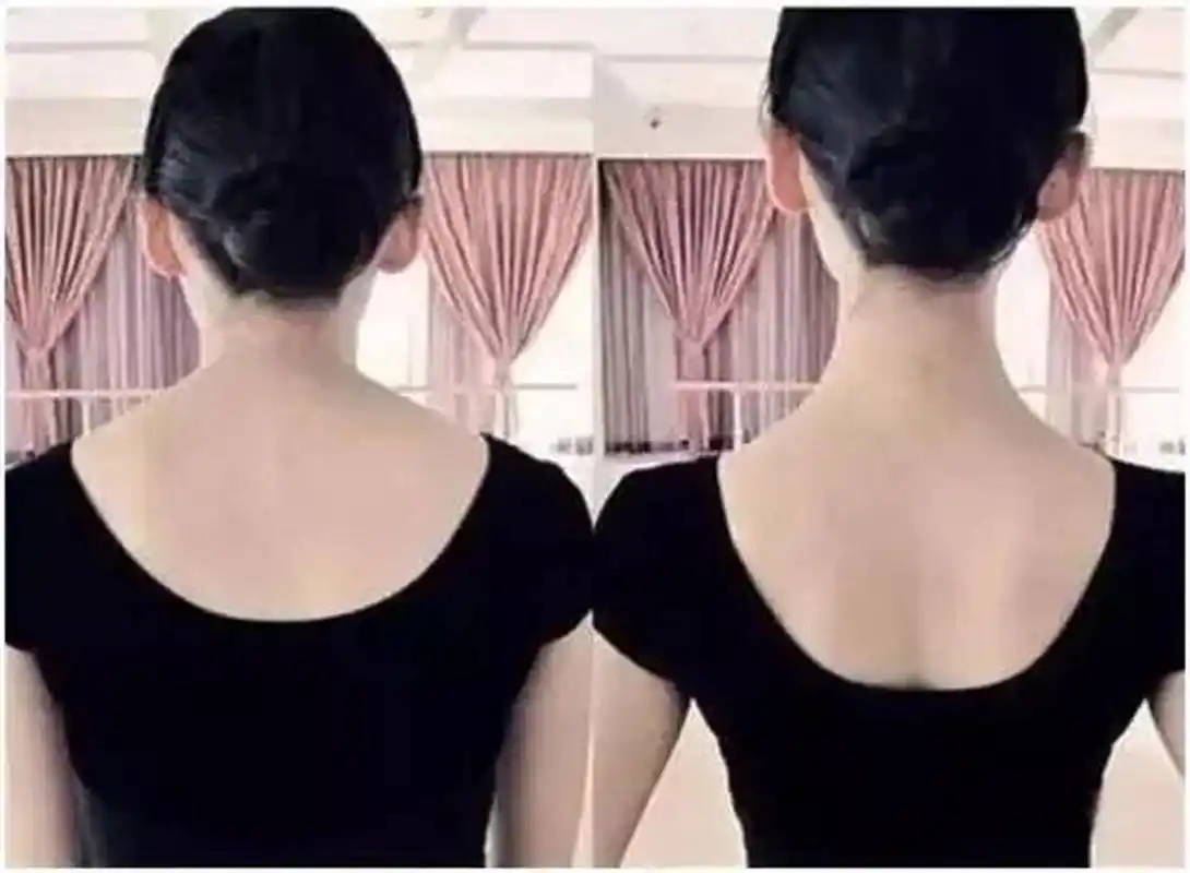 斜方肌鼓起来,肥大如何处理? 斜方肌肥大或者劳损紧张的原因: 1.