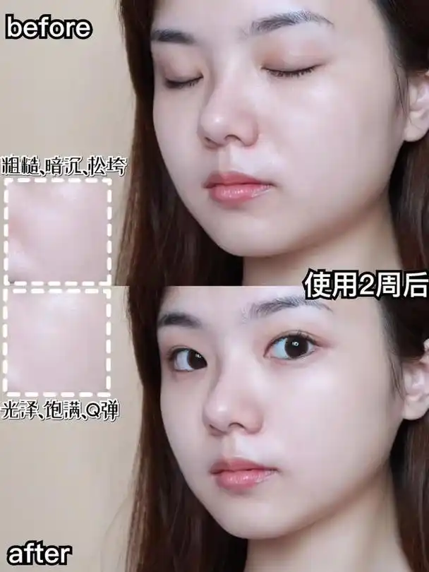 秋季护肤补水保湿还抗老的面霜?_皮肤