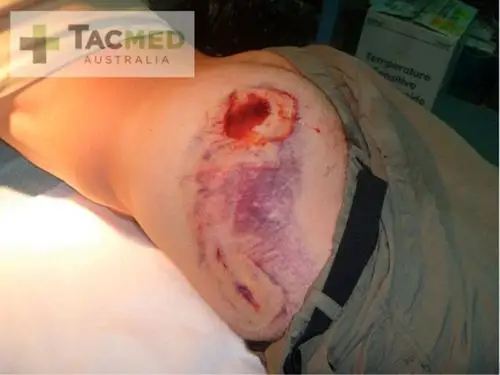 特种军医解释为何相比m4他"更愿"被ak-47击中