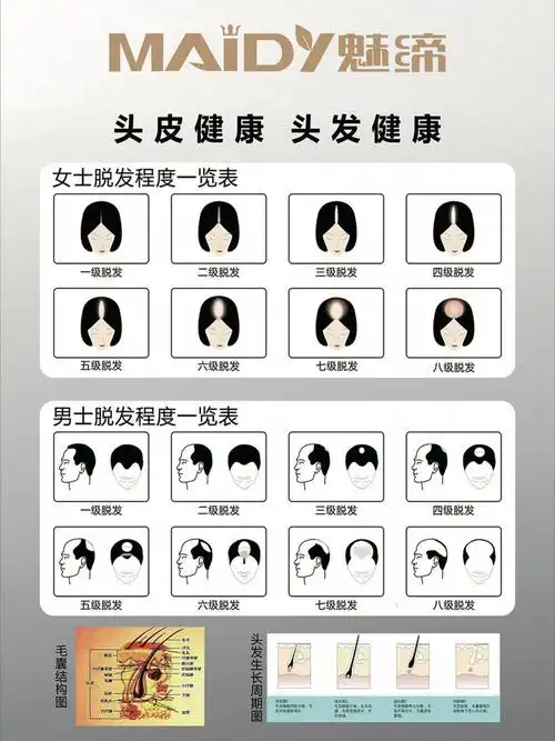 脱发程度对应表,你的头发还好吗?