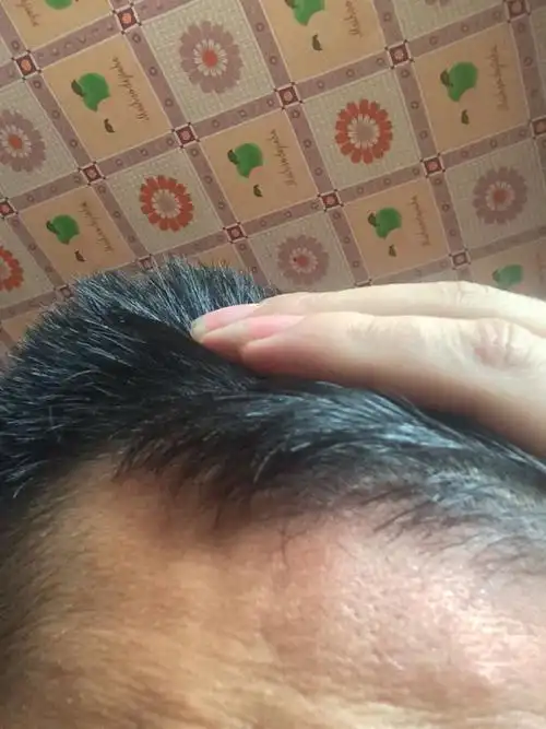 发根这样长,头发也干,一长出来就卷,怎么办