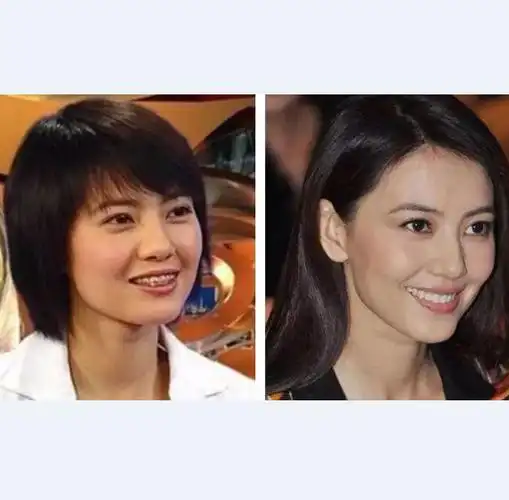 因整牙而变美的女明星,学学啦!