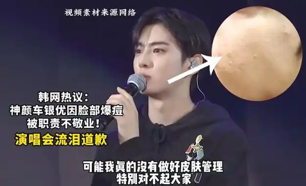 毛孔|肤质|祛痘|角质|痘痘|长痘|皮肤科医生_网易订阅