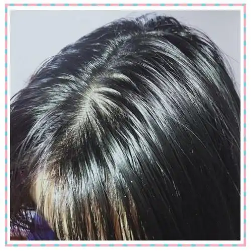 油性发质,而且掉头发,一般一天洗一次头发,用什么洗发水比较好?