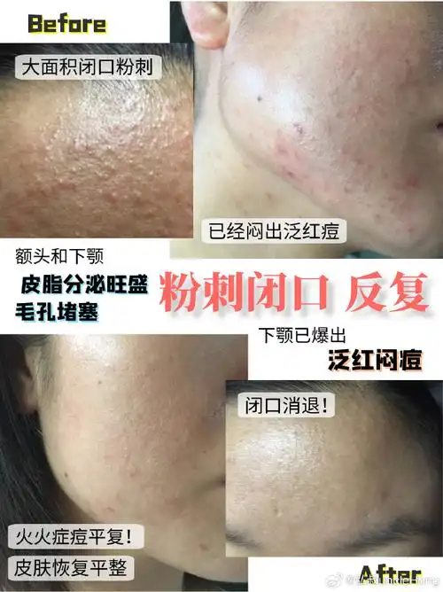 美丽觉醒计划##好肌肤养成记##换季脆敏皮的底层逻辑