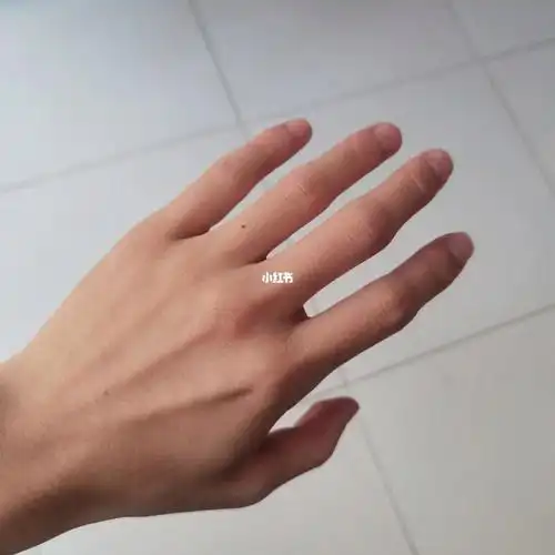 无名指长痣