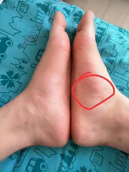 有疼痛感,不强烈.