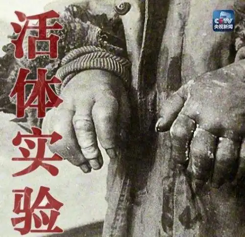 一提的是,尽管通过资料,很难确定侵华日军是否在香港有过人体活体实验