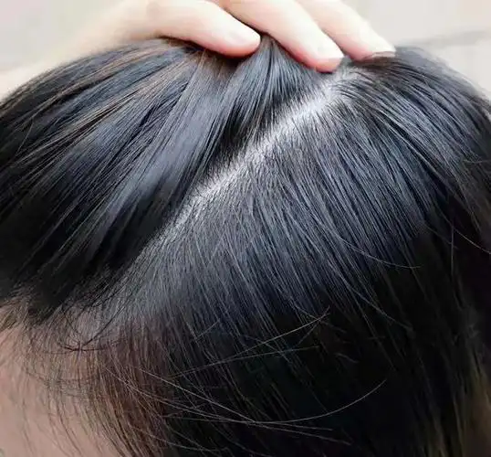 白发变黑(白发变黑发哪个产品效果好) - 月牙知识库