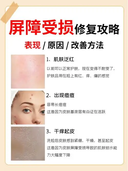 皮肤屏障受损需要使用一些修复类产品进行调理,能够增加皮肤的抵抗力