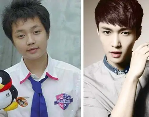 【图】张艺兴整容前照片太吓人 竟撞脸杜海涛