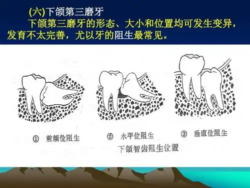 口腔下颌磨牙解剖形态ppt