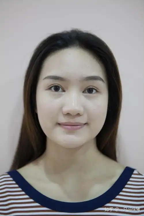 拥有宽鼻翼大鼻头是怎样一种体验