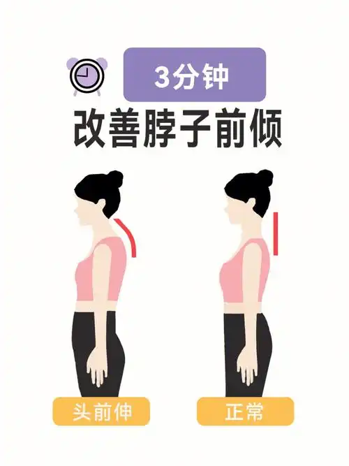 5个动作速成天鹅颈丨改善脖子前倾富贵