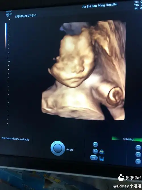 四维一次过,是个儿子