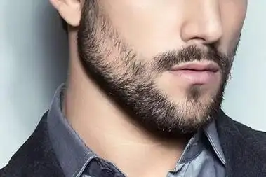 怎么把络腮胡去掉_怎么留络腮胡子_整形房五六