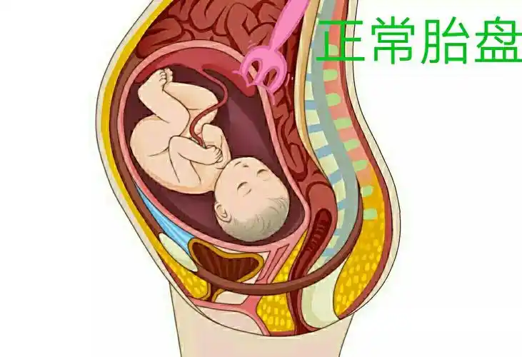正常位置胎盘