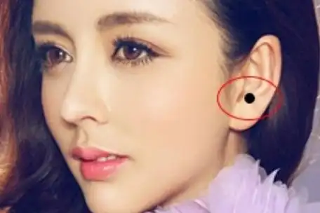 耳朵有痣代表什么图解 耳朵有痣的女人代表什么意思