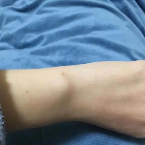 这个红色的是朱砂痣吗