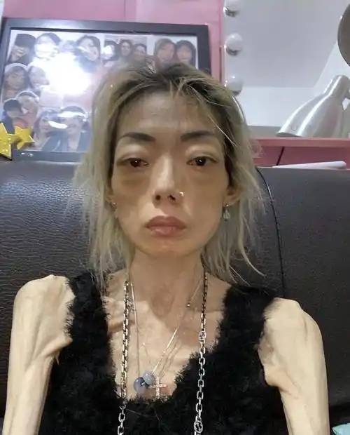 嫁入豪门的伍智恒:结婚8年瘦到只剩44斤皮包骨,她经历了什么?