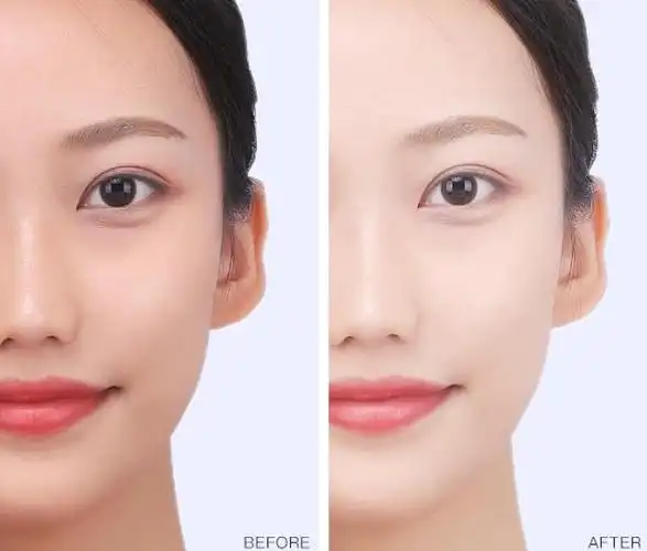 最近非常火的美白面膜之一,李佳琦也推荐过,用后皮肤真的变白了