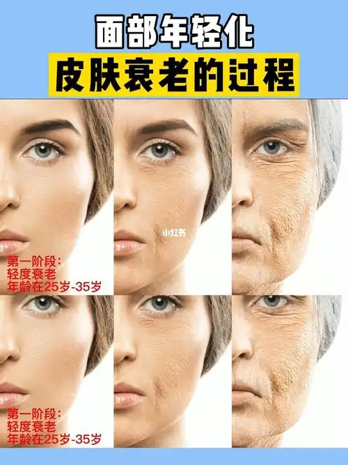面部年轻化皮肤衰老全过程过程