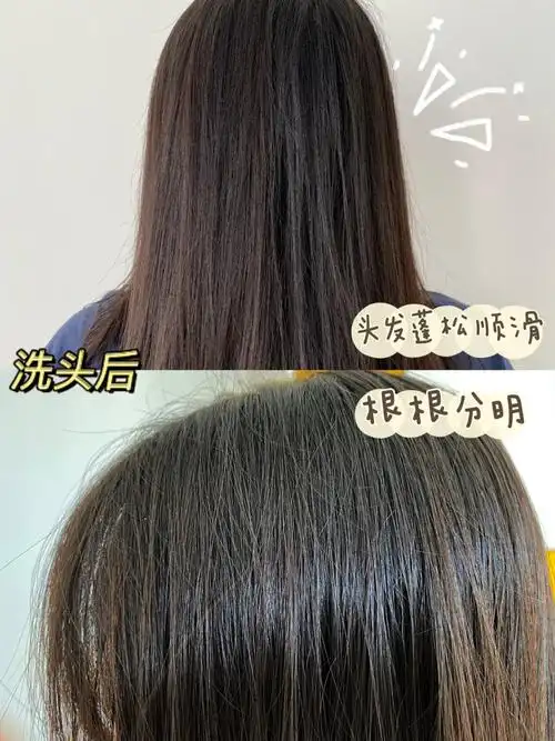 油性发质而且掉头发一般一天洗一次头发用什么洗发水比较好