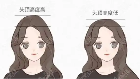 高颅顶和低颅顶对比236z.com