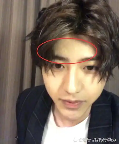 蔡徐坤无滤镜素颜直播却不慎暴露脸部缺陷连服务器都卡了