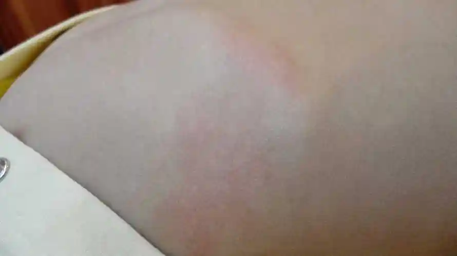 宝宝水土不服身上起疹子怎么办?