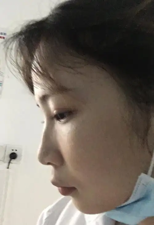 第一次觉得自己凸嘴,好难看的侧脸