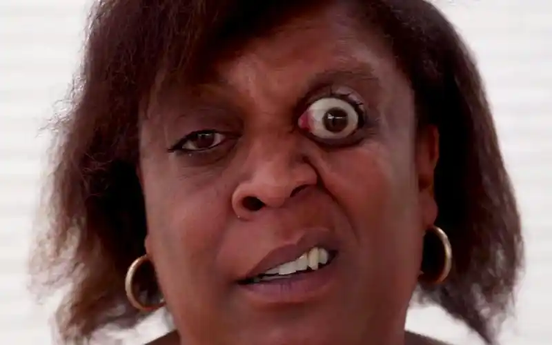 世界上最惊悚的纪录眼睛向外突出11毫米外星人的既视感