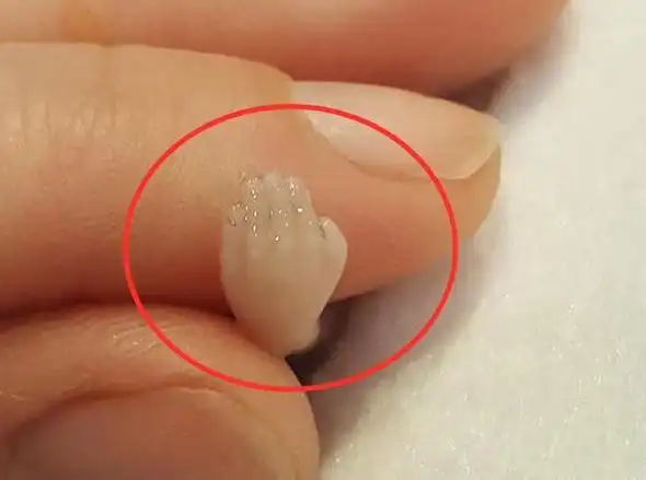 怀孕14周后流产,妈妈网上分享胎儿照片,仅10厘米但手脚都已成型