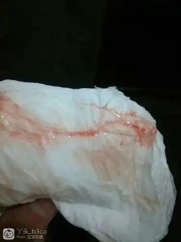 宝妈帮忙看看不懂今天早上四点多见红是不是不是快生了