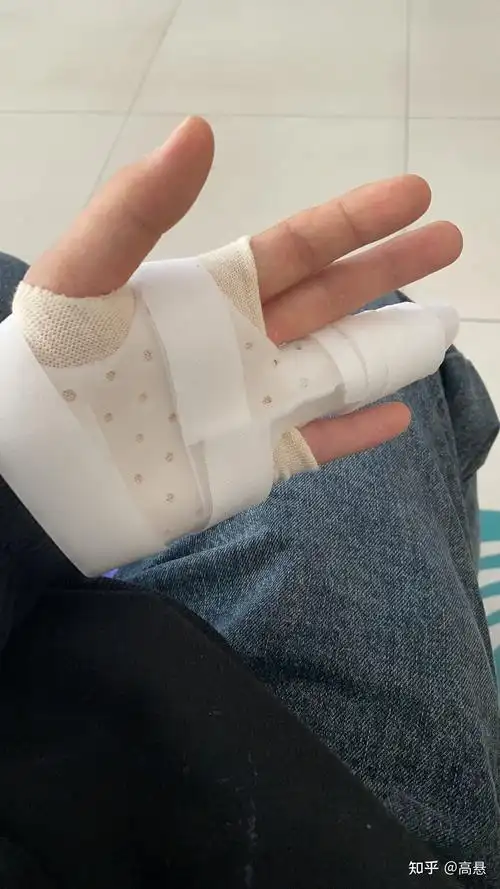 手指环指伸肌腱断裂恢复过程