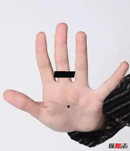 女人痣的位置与命运图解 身上的巨富痣长在什么位置