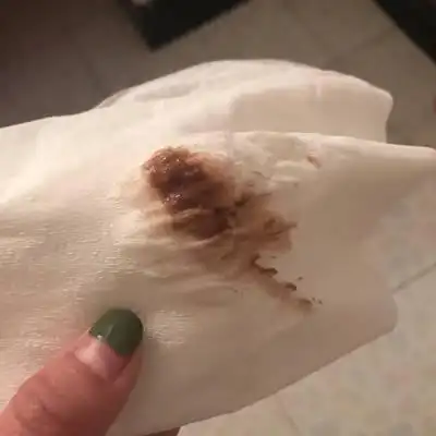 我怀孕6周4天了,前三天卫生间就出了红色的血,大前天上卫生间一出力就