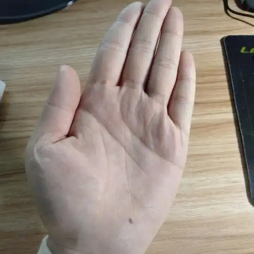 女生左手上手心有一颗痣是什么寓意吗