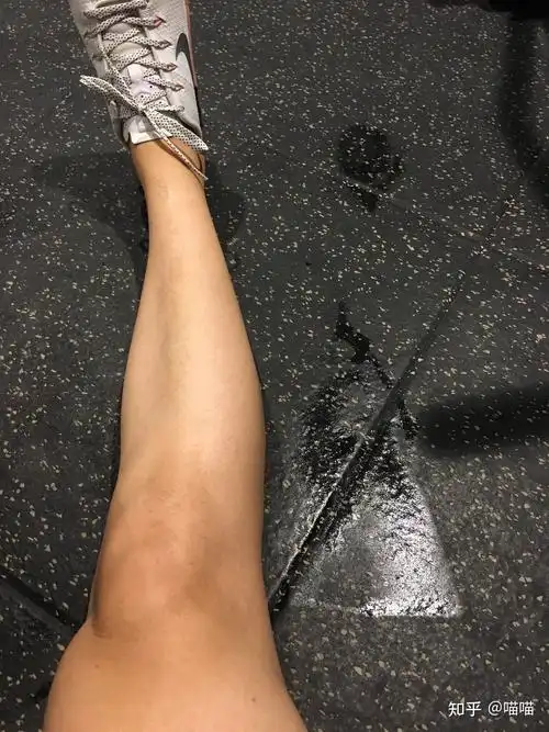 肉滚滚有线条的小腿不好看吗? (小腿形状看基因的,别挣扎)