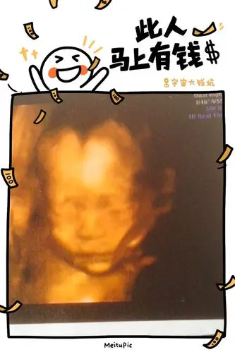 四维彩超回来,感觉宝宝好丑啊!