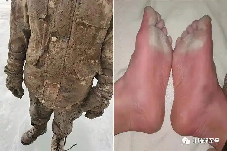 还记得那一双双冰冻脚吗这次成了泡白脚